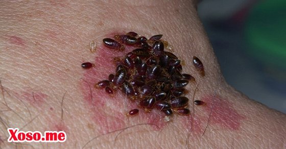 Mơ thấy bị rệp cắn là có người muốn đẩy mình vào nguy hiểm 