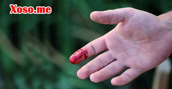 Chiêm bao thấy bị thương đánh con gì? Chiêm bao thấy bị thương đánh con gì?